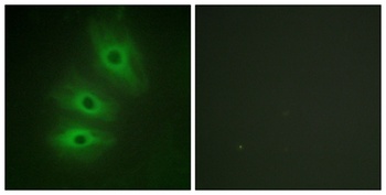 A Cyclase V/VI antibody