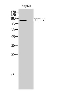 CPTI-M rabbit pAb