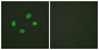 Chk2 (phospho Thr383) rabbit pAb Antibody