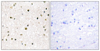 AKAP 220 rabbit pAb Antibody