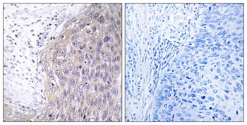 DNA pol γ2 rabbit pAb