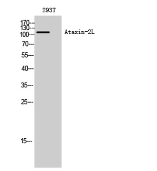 Ataxin-2L antibody