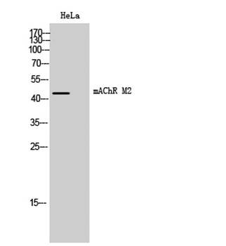 mAChR M2 antibody