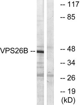 VPS26B rabbit pAb Antibody