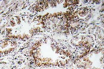 AChR alpha 1 antibody