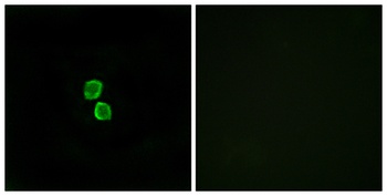 CMTM1 antibody