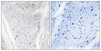 Alpha-protein Kinase 2 antibody