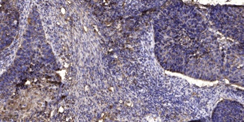 DHRS1 antibody