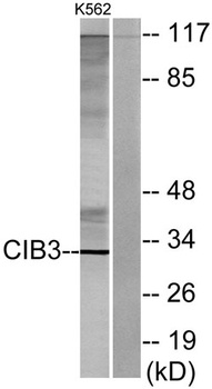 CIB3 rabbit pAb Antibody