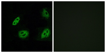 Olfactory receptor 4B1 rabbit pAb Antibody
