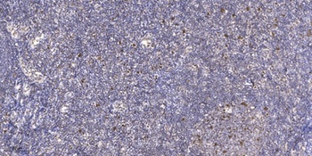 JDP2 (phospho Thr148) rabbit pAb