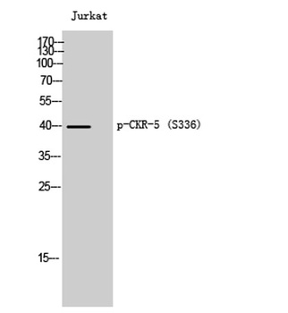 CKR-5 (phospho-Ser336) antibody