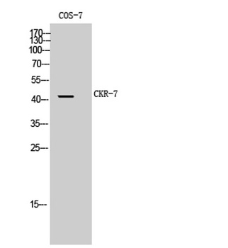 CKR-7 antibody