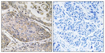 cPLA2-ε rabbit pAb