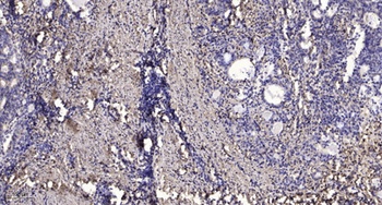 TRAPPC5 rabbit pAb
