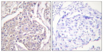 HSP20 (phospho Ser16) rabbit pAb Antibody