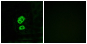 Olfactory receptor 2T10 rabbit pAb Antibody