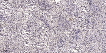 Podocan antibody