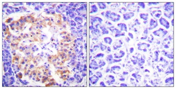 COL3A1 rabbit pAb Antibody