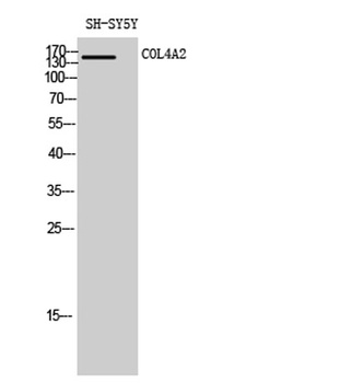 Collagen IV antibody