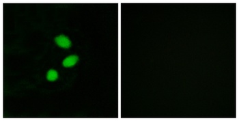 TSHZ2 antibody