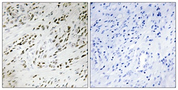 TSHZ2 rabbit pAb Antibody