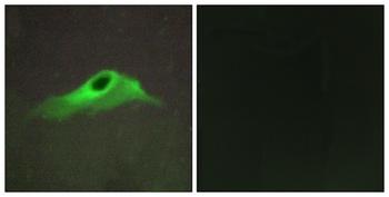 COL4A5 rabbit pAb Antibody