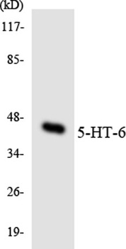 COL4A5 rabbit pAb Antibody