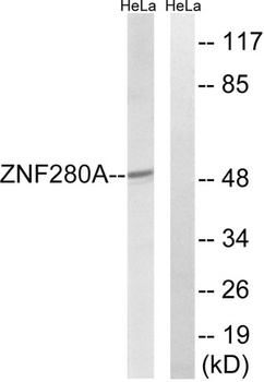 SUHW1 rabbit pAb Antibody