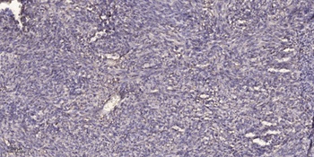 SUHW1 rabbit pAb Antibody