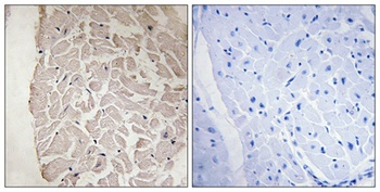 Collagen VI antibody