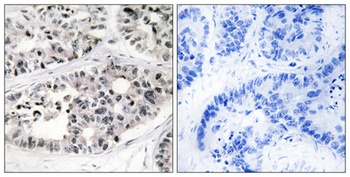 COL7A1 rabbit pAb Antibody