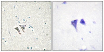 ACTR-IC rabbit pAb Antibody