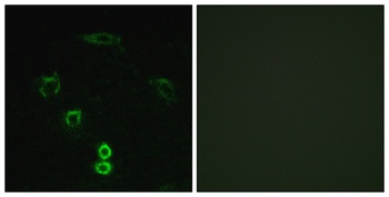 Glycerate Kinase antibody