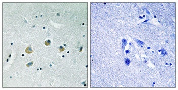 Cot (phospho Ser400) rabbit pAb