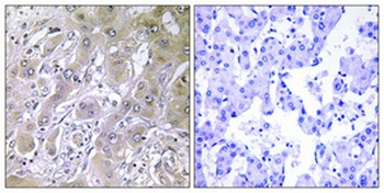 ACOT12 antibody