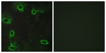 Adenosine A2A-R rabbit pAb