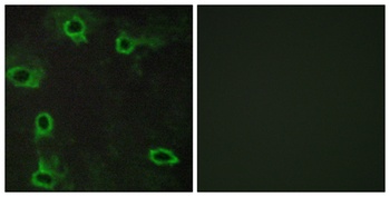 ADORA2A antibody