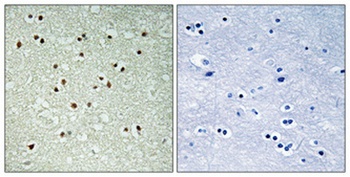 NCoA-7 rabbit pAb