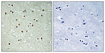 NCoA-7 antibody