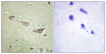 COX15 antibody