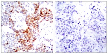 ATF-2 (phospho Thr69) rabbit pAb
