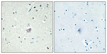 CRF-RII antibody