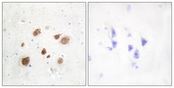 CaMKIβ rabbit pAb