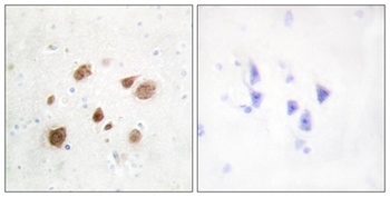 CaMKI beta antibody