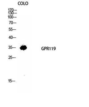 GPR119 rabbit pAb Antibody