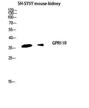 GPR119 rabbit pAb Antibody