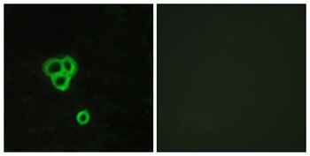 GPR119 rabbit pAb Antibody