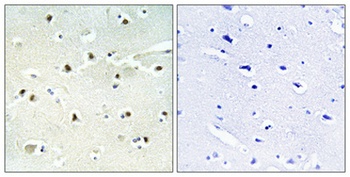 S-100A16 antibody