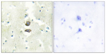 KG19 antibody